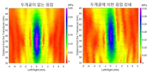 두개골 유무에 따른 음압 차이