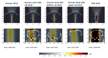 사람의 두개골 조각과 소동물 (Rat) 두개골 구조 정보를 결합하고, 0.25MHz의 초음파가 150μs 동안 조사되는 환경을 삼차원 집중초음파 시뮬레이션
