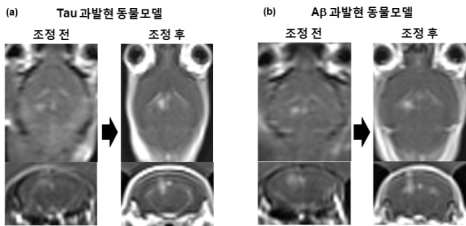 (a) Tau 과발현 동물모델과 (b) Aβ 과발현 동물모델의 MR 영상 향상에 따른 알츠하이머 동물모델 BBB 개폐 최적화