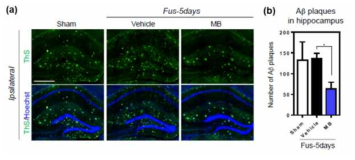 (a) APP/PS1 Amyloid β plaque 염색 (b) 초음파 조사 5일 후 amyloid β 확인