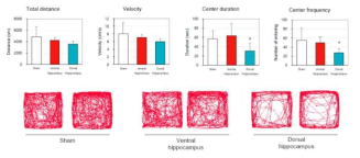 대조군과 Dorsal hippocampus, Ventral hippocampus BBB 개통 그룹에서 Open field test 결과
