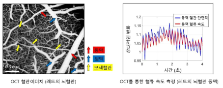 OCT를 이용한 Rat 의 angiogram과 혈류 속도 측정 결과