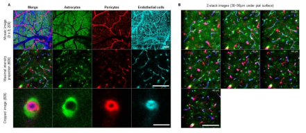형광단백질 발현 동물 모델을 이용한 신경혈관단위 동시 영상화