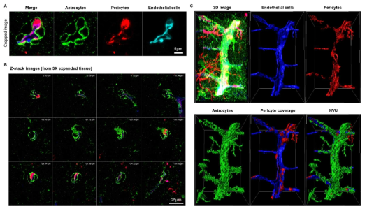 (a) Endothelial cell이 염색된 NG2-DsRed x Aldh1l1-GFP 마우스의 뇌조직을 Expansion microscopy기법으로 3배 확장하고 신경혈관단위의 이미지를 획득함(녹색, Aldh1l1-GFP, Astrocyte; 빨강, NG2-DsRed, Pericyte; 파랑, Endothelial cell, CD31 labeling). (b) 3배 확장된 샘플의 z-stack 이미지. (c) z-stack 이미지를 이용한 3D rendering을 통한 3차원 재구성