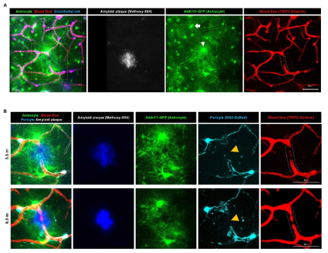 (a) 퇴행성 뇌질환 모델에서 신경혈관단위의 미세구조 변화를 확인하기 위하여, NG2-DsRed x Aldh1l1-GFP x APP/PS1를 확립하고, 5.5개월에 영상화를 진행함. Methoxy-X04를 이용하여 amyloid plaque를 염색함. (b) 5.5개월과 6.5개월 시점에 신경혈관단위를 영상화하고, TRITC-Dextran를 주입하여, 혈류를 확인함