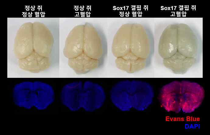 고혈압을 유도한 Sox17 결핍 생쥐에서 뇌혈관장벽 붕괴가 발생