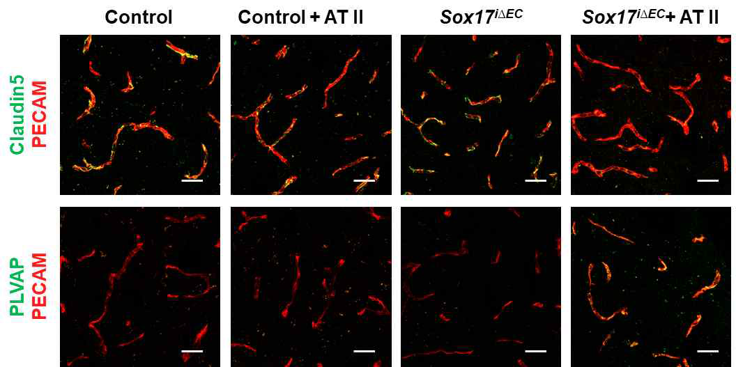 고혈압 Sox17 결핍 생쥐에서 Claudin5의 발현 감소 및 PLVAP 발현 증가