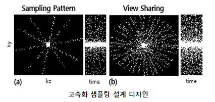 시공간 차원 방향으로의 고속화 샘플링 패턴 디자인