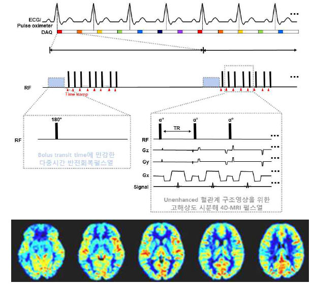 개발된 Bolus transit time에 민감한 다중반전 회복 기반 동적스핀 표지 4D-MRI 펄스 시퀀스 및 해당 MRI 펄스열을 통해 획득한 동적스핀표지 영상