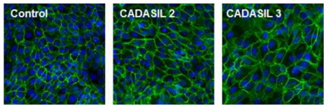 GLUT1 면역 염색. Control에 비해 CADASIL 환자 BMEC이 더 크게 보이며, 세포간 위아래로 더 겹쳐있는 현상이 관찰됨