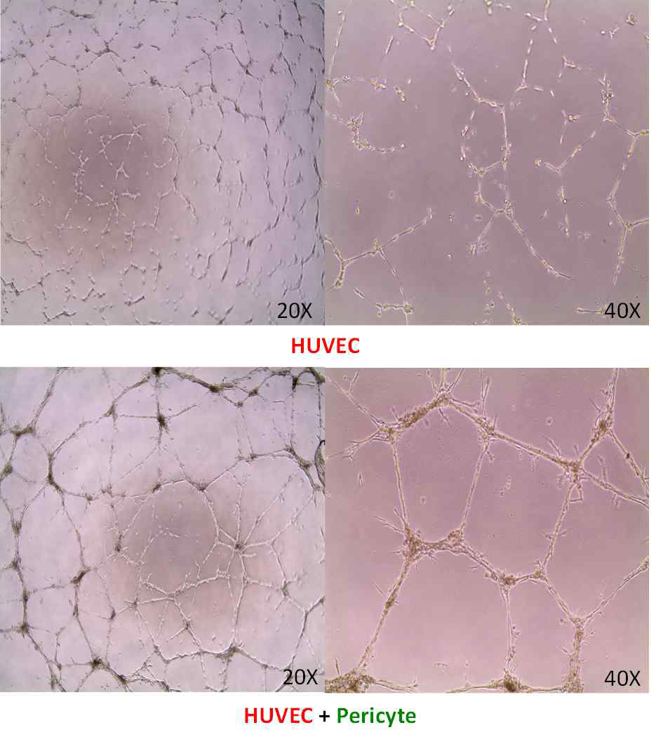 HUVEC 혈관내피세포 및 역분화줄기세포 유도 혈관주위세포를 공배양했을 때 tube formation을 조사함