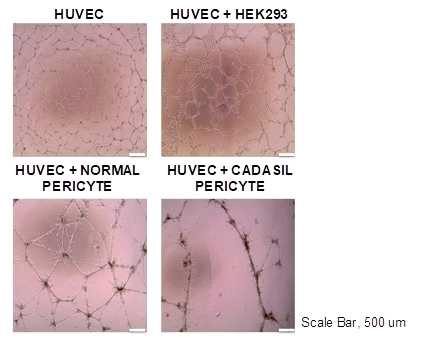 HUVEC 내피세포와 iPSc 유래 혈관주위세포 공배양을 통한 tube formation assay. 혈관 형 성능을 관찰