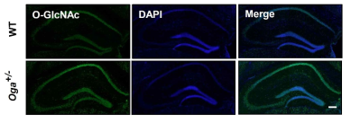 Oga heterozygous 마우스 뇌의 해마 영역에서 증가한 O-GlcNAc 당화