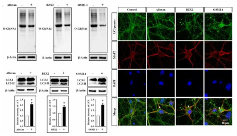 OGT inhibition increases autophagy