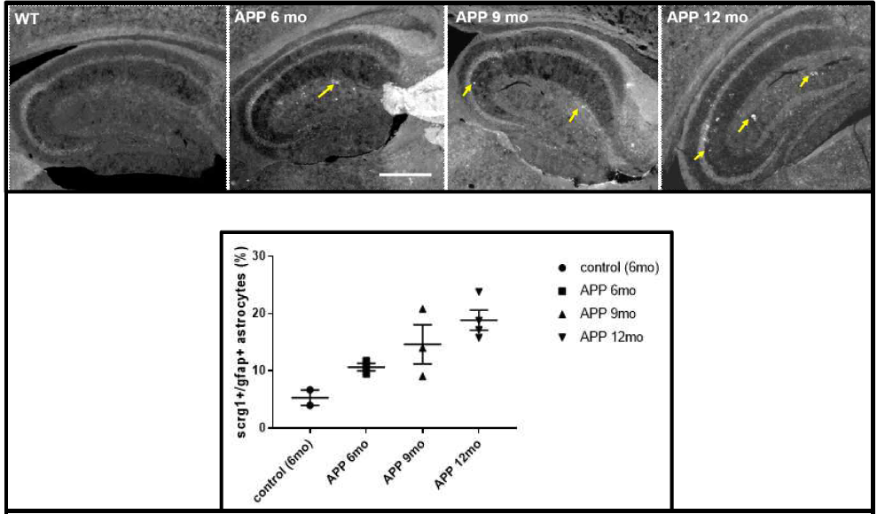 APP/PS1 알츠하이머 병 모델 해마 지역에서 점진적으로 증가하는 SCRG1-positive 한 별아 교세포