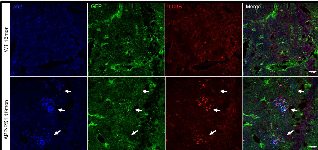 알츠하이머 모델 APP/PS1에서 선택적으로 증가해 있는 별아교세포 autophagosome 축적현상