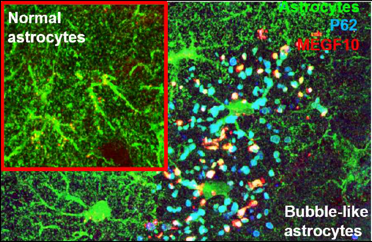 알츠하이머 별아교세포 autophagoso me에 비정상적으로 축적되어 있는 MEGF10 단백질