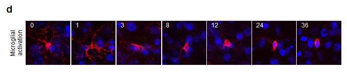 D) 신경염증 확인을 위한 Microglial 세포 활성