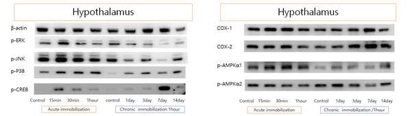 Acute와 chronic immobilization 스트레스 모델의 hypothalamus(시상하부)에서 여러 signal 단백들의 발현 변화