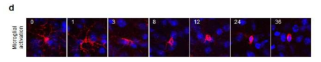 D) 신경염증 확인을 위한 Microglial 세포 활성