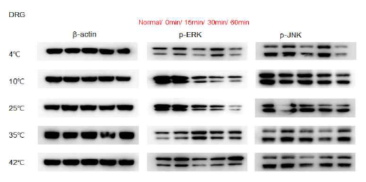 마우스를 여러 다른 온도의 물에 3분간 swimming stress에 노출 시켰을 때, DRG의 ERK와 JNK 단백의 인산화에 미치는 영향