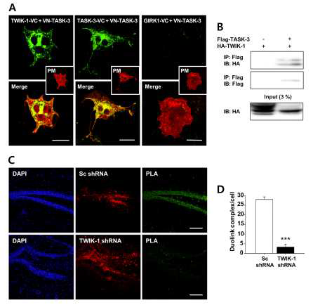해마의 dantate gyrus granule 신경세포에서 TWIK-1은 TASK-3와 이종결합 이온통로를 형성함