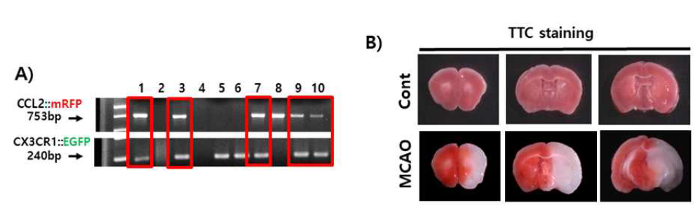 이중염증형광표지 마우스 유전형질 및 뇌 허혈 손상 분석