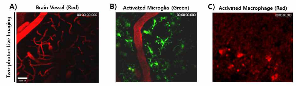 이광자현미경을 이용하여 뇌혈관 및 뇌염증 관여 세포 관찰