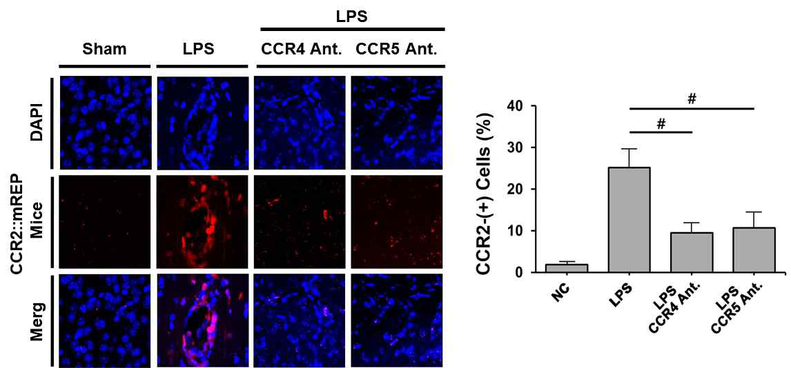뇌염증 반응시 CCR4와 CCR5의 길항제 주입시 혈액유래 대식세포 조직면역화학 염색