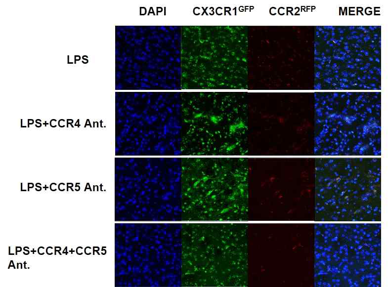 CCR4와 CCR5 길항제 처리 후 미세아교세포 및 단핵구 관찰