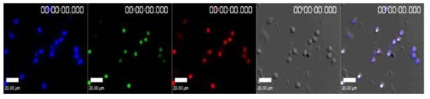 CCR2와 CX3CR1 비장세포의 라이브 세포 이미징