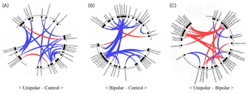 청년기 우울증 아형에 따른 대뇌 기능적 연결성 비교 결과 (A) Unipolar vs Control (B) Bipolar II vs Control (C) Unipolar vs Bipolar II