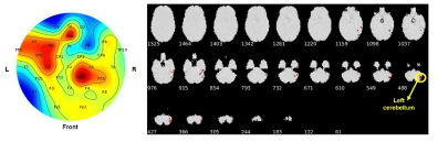 DCCA를 통해 추출한 EEG, fMRI 특징