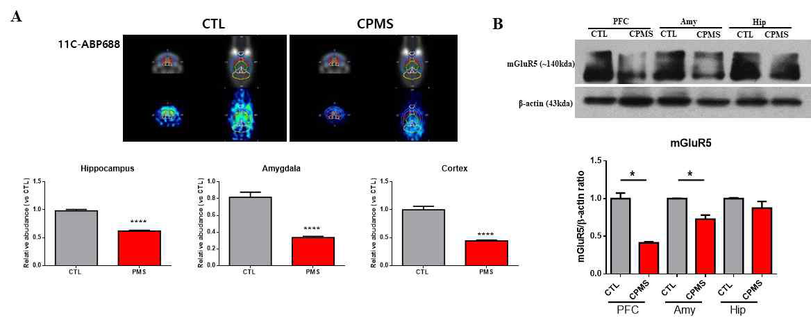 [11C]ABP688 분자뇌영상에서 도출한 부위별 결합능 값(BPND) 및 mGluR5 발현량 비교
