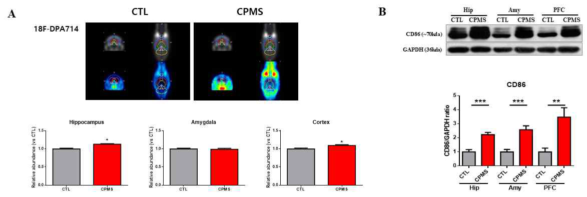 [11F]DPA714 분자뇌영상에서 도출한 부위별 결합능 값(BPND) 및 CD86 발현량 비교