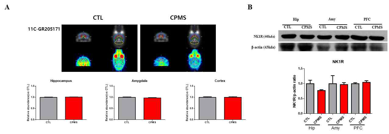 [11C]GR205171 분자뇌영상에서 도출한 부위별 결합능 값(BPND) 및 NK1R 발현량 비교