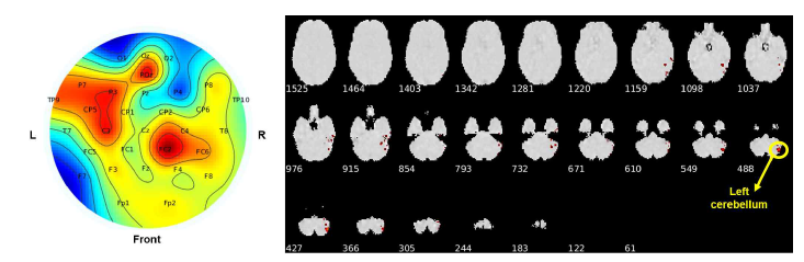 DCCA를 통해 추출한 EEG, fMRI 특징