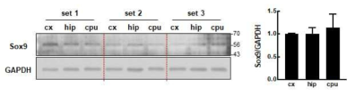 Sox9 expression in different brain regions