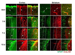 Blood vessel formation play critical roles for astroglial scar formation in the cortex and the striatum