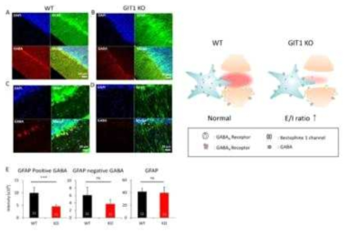 GIT1 KO ADHD mouse model에서 glial GABA와 tonic inhibition