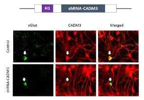 타겟단백질 (CADM3) shRNA모식도(위), shRNA를 세포에 주입하여 타겟단백질의 효과적 발현저해를 면역형광법으로 확인함 (아래)