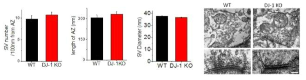 DJ-1의 결핍 시냅스에서 전자현미경을 통해 미세구조의 변화를 분석 (왼쪽) 하고 그 미세 구조 사진 (오른쪽)
