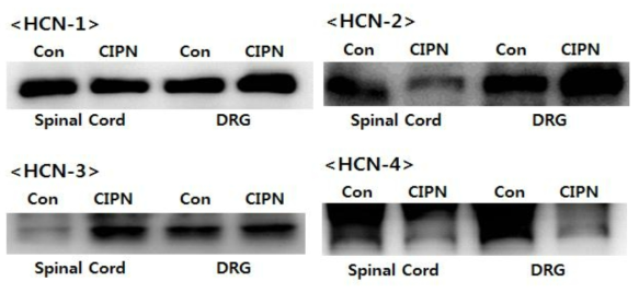 Vincristine 유도 CIPN 모델에서 Spinal cord와 DRG의 HCN-1, HCN-2, HCN-3, 그리고 HCN-4 채널들의 발현에 미치는 영향