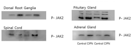 Vincristine 유도 CIPN 모델에서 여러 조직에서 JAK2의 인산화 발현에 미치는 영향