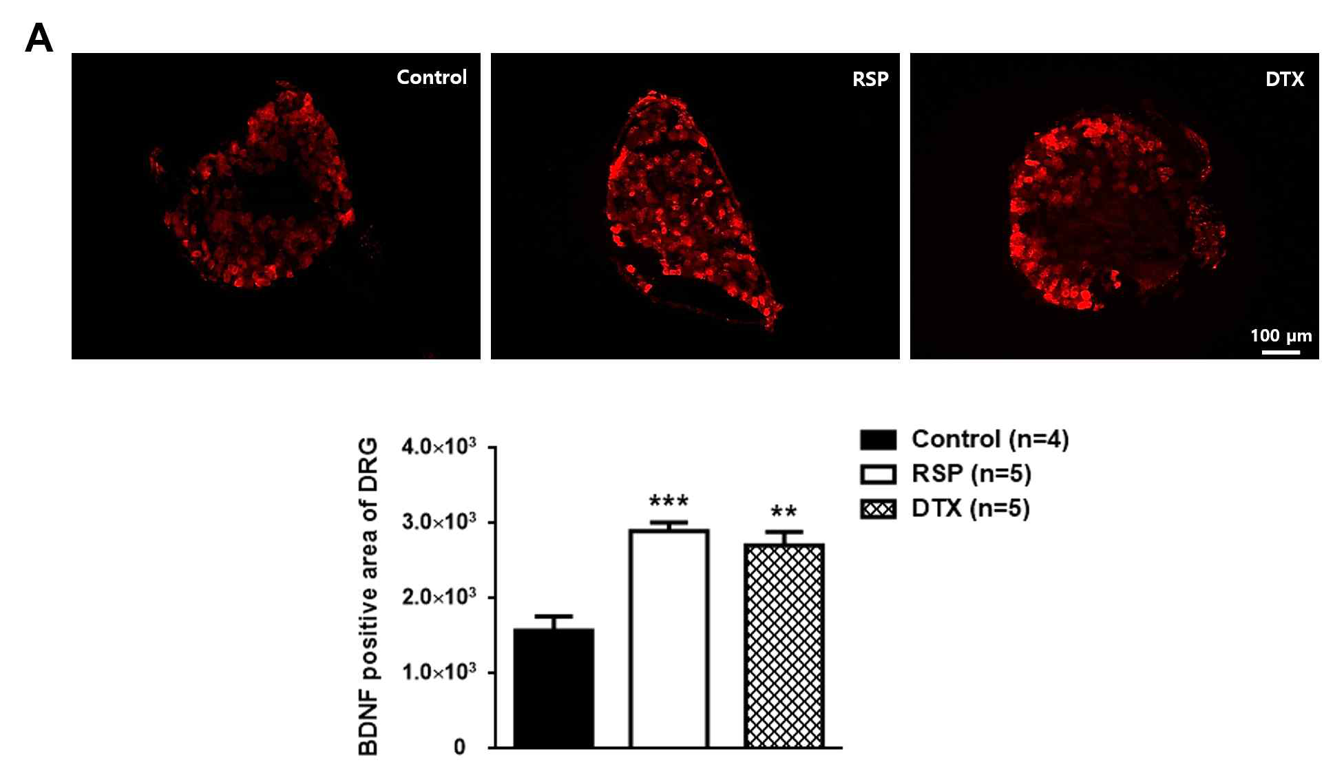 Resrepine(RSP) 및 Docetaxel(DTX) 각각 주사 후, 말초신경계(DRG) BDNF의 변화 (Data not published)