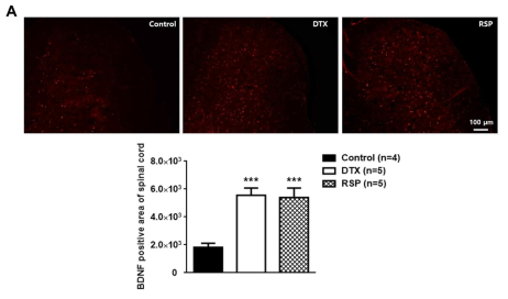 Resrepine(RSP) 및 Docetaxel(DTX) 각각 주사 후, 중추신경계(Spinal cord) BDNF의 변화 (Data not published)