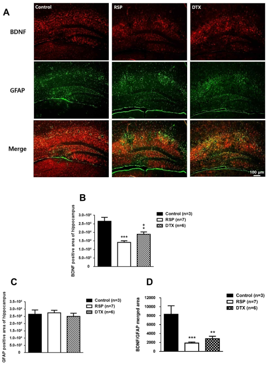 Resrepine(RSP) 및 Docetaxel(DTX) 각각 주사 후, 중추 신경계(Hippocampus)의 BDNF의 변화 및 성상 세포(Astrocyte) 표지물질　변화 (Data not published)