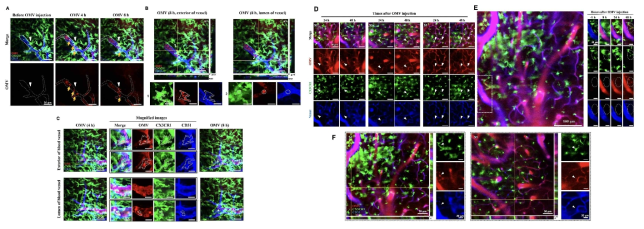 A.a의 세포밖소포체와 세포밖소포체 속 exRNA가 생쥐의 뇌막에 있는 macrophage와 뇌의 microglia에 전달됨을 intravital imaging을 통해 확인 (A-F) (Ha. et al., 2020)