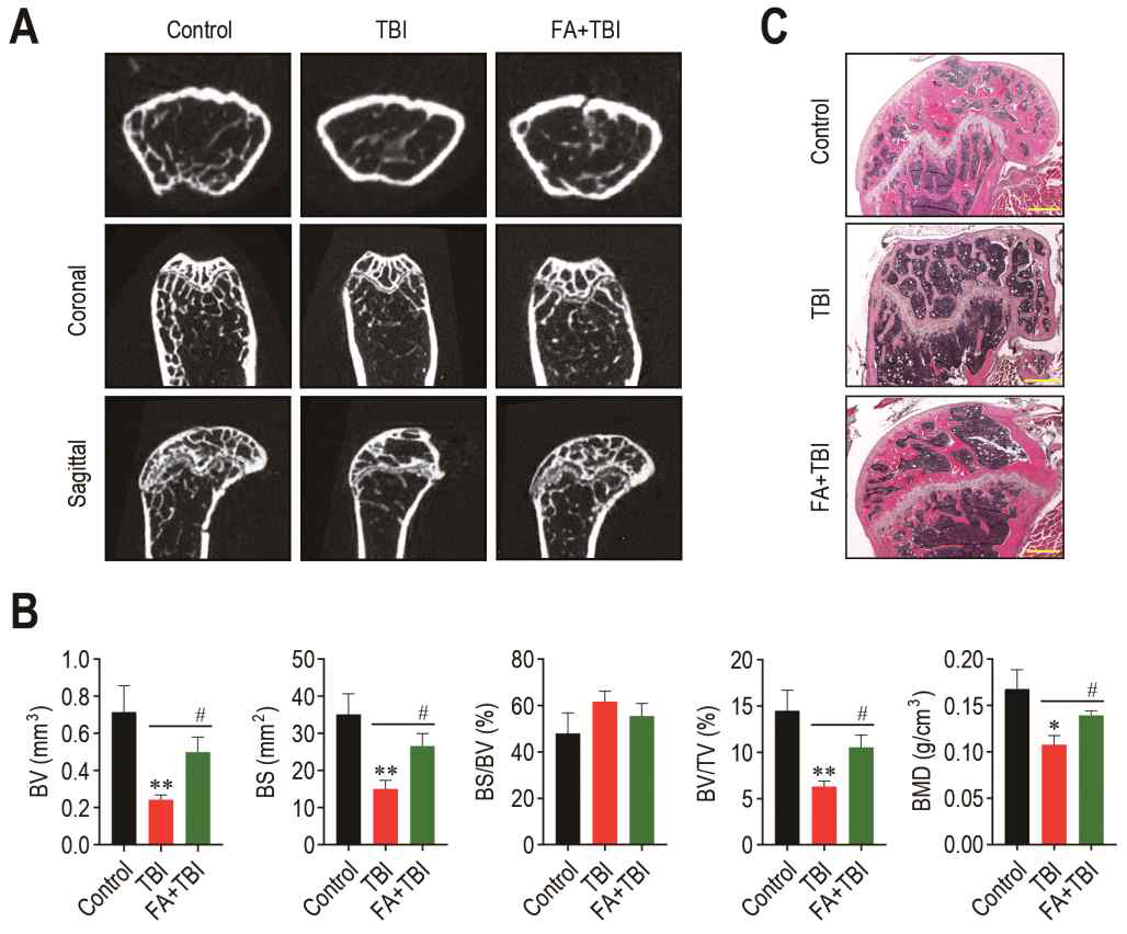 Effects of TBI or in combination with FA on BM microenvironments. (A) Micro-CT, (B) values of bone parameters, and (C) H&E staining results are shown