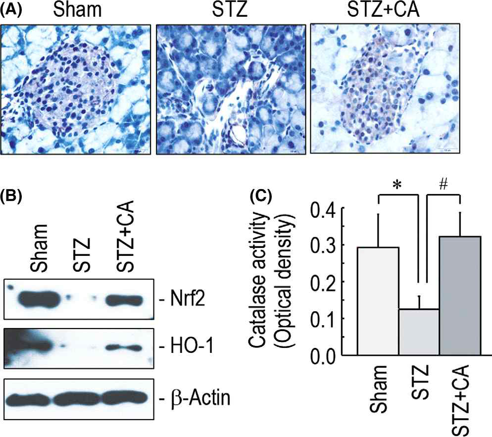 Effect of coumaric acid (CA) on (A) STZ-induced pancrea damage and (B) NRF2 expression